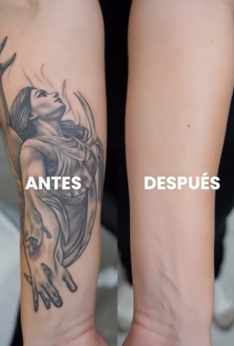 Evolucion de tatuaje en brazo